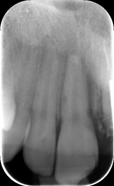 Kps19vkkbduyokg6v35y - Eugenol