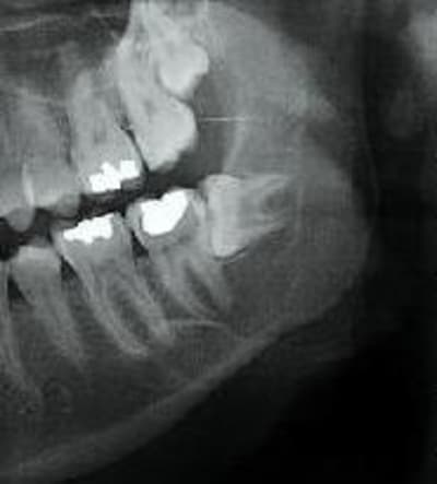 Kystepaxv2 vexkox - Eugenol