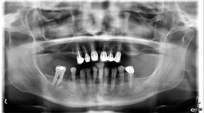 L6bjmyhkfzrdjuli7ug4 - Eugenol