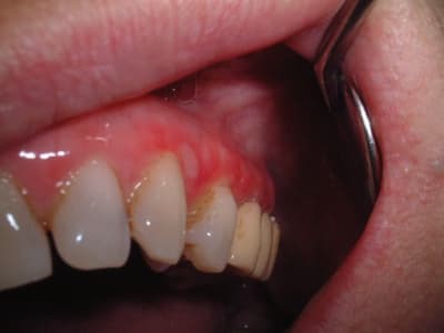 Lauwers3 jwnvte - Eugenol