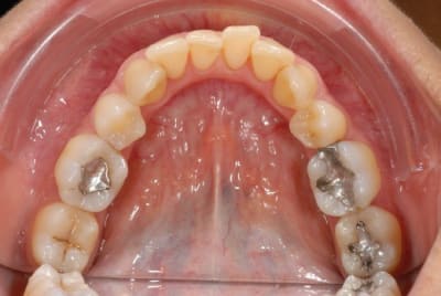 Le d par en bas jw6vgb - Eugenol