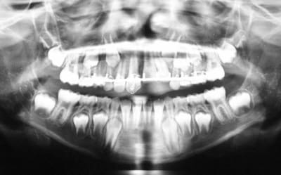 Lee roy wlghaj - Eugenol