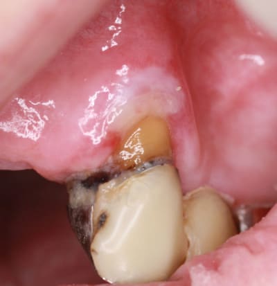 Lesion1net s8psbq - Eugenol