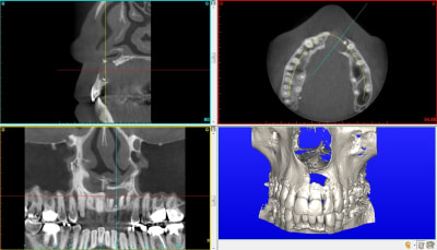 Lievoux bruno aperçu elo9h7 - Eugenol