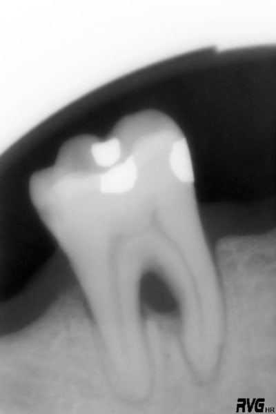 Lionel emdhu3 - Eugenol