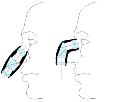 Loupes znh3ui - Eugenol