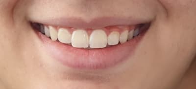 Lp5xkxgpffg1ajn2prs36srjy1xj - Eugenol
