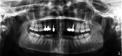 Lwzn8npoafrfzdqb9mvk - Eugenol