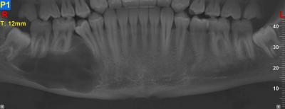 M56ad13mpwycxir78hdu9tc9md99 - Eugenol
