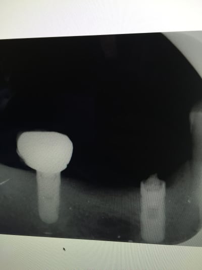 M6dwokdup30xnmrw7imo - Eugenol