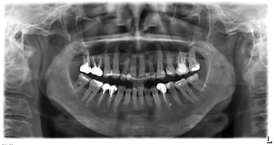 M6ibzukdh1la6ouzwt2x - Eugenol