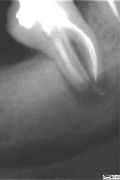 Marroux1 yqm1bv - Eugenol