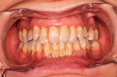 Mars2016 070 qg5blr - Eugenol