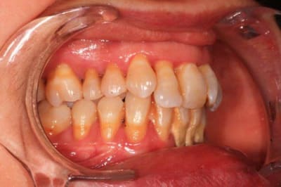 Mars2016 072 d6mov6 - Eugenol