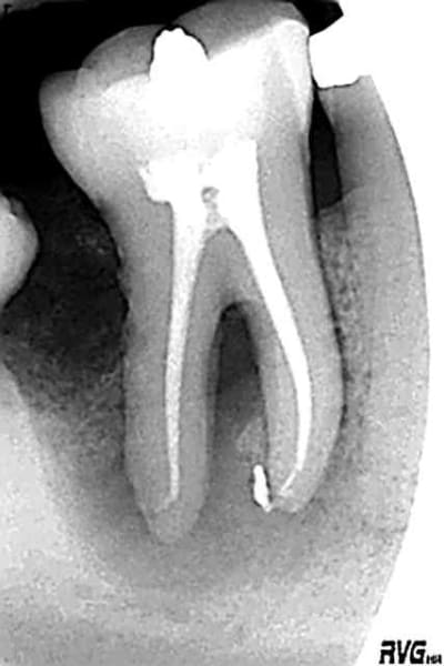 Mars 2009 p3kaud - Eugenol