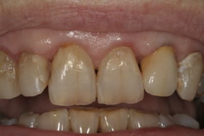 Md ferrierr000 zbrczo - Eugenol