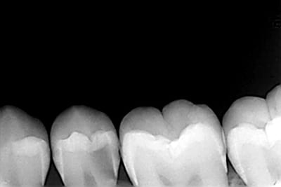 Me1 l31alg - Eugenol