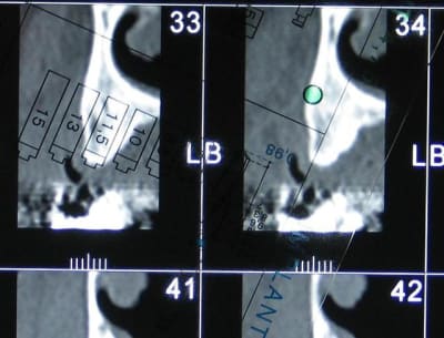 Mesure sur scan uiqwlk - Eugenol