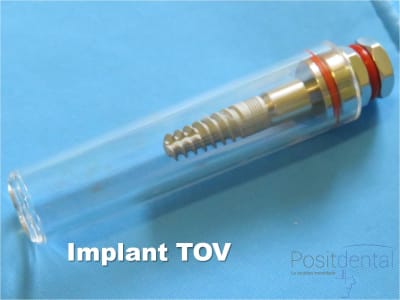 Mise en charge immédiate   implant tov  positdental 011 q6vdht - Eugenol