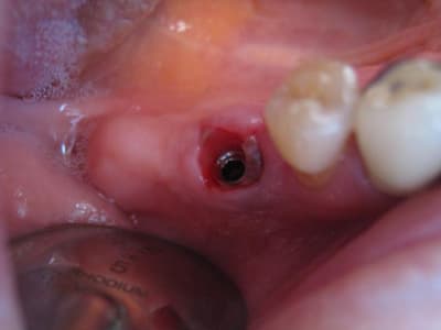Mise en fonction ngzw9p - Eugenol