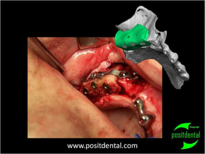 Mod le 3d st rile guide de d coupe 3 aawb0j - Eugenol