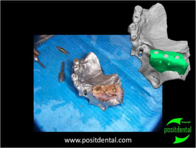 Mod le 3d st rile io1vun - Eugenol