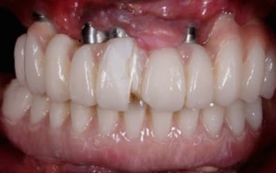 Mon beau sourire qp8vjd - Eugenol