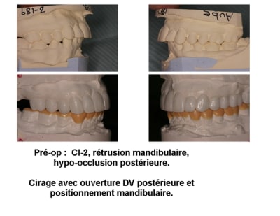 Montage nm  1  aslday - Eugenol