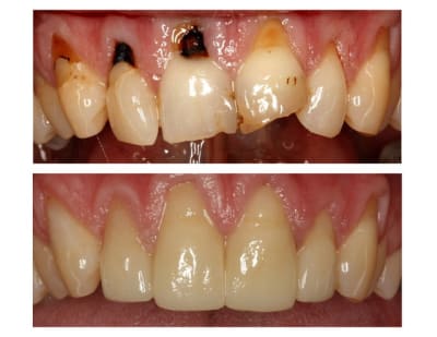 Montage  6 mois  m4wfkl - Eugenol