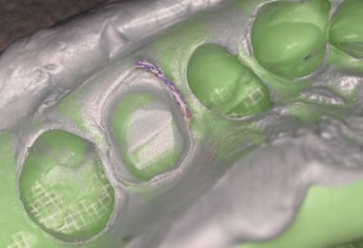 Mordu dvs3r3 - Eugenol