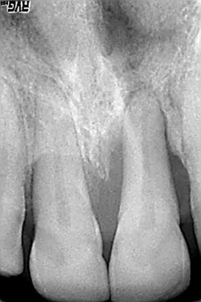 Murielle opatc5 - Eugenol