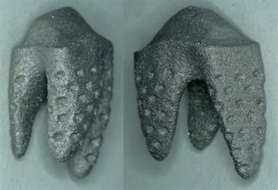 Natural dental implants presents 3d printed replicate tooth ids 2017 1 ktbsdd - Eugenol