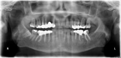 Ne1 lxetkf - Eugenol