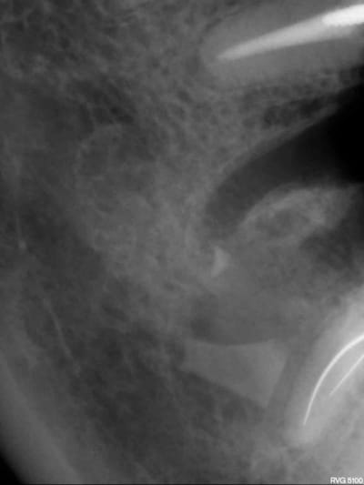 Ne2 rcqawo - Eugenol