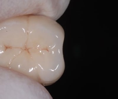 New h8yles - Eugenol