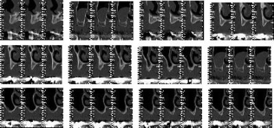 Nouveau 5 ycpthe - Eugenol