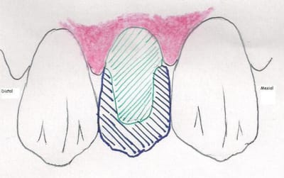 Num risation0001 t8qh8p - Eugenol