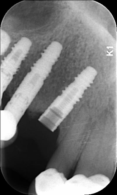 Nx74xmoogjpnjz8pwbxg - Eugenol