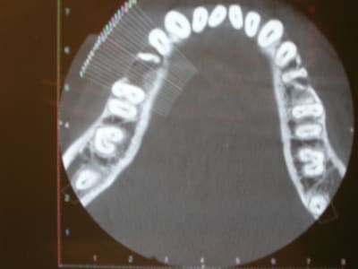 Obsqy63zib5aelct7uom - Eugenol