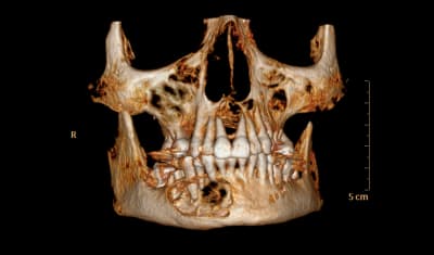 One0sh8fv83wj7mire04 - Eugenol