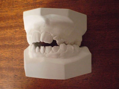 Ortho03 copie hlrd04 - Eugenol