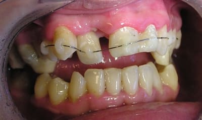 Ortho 14 11 07 lz59jm - Eugenol