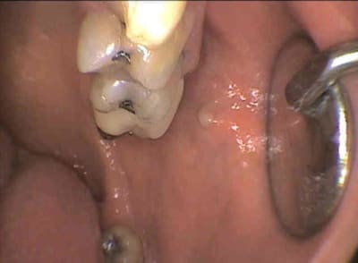 Ostium q9jjll - Eugenol