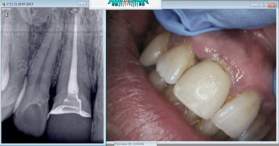 Ozq6bgultyhxjqre7fwb - Eugenol
