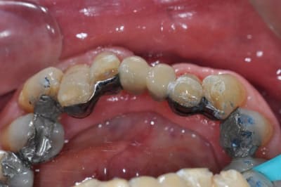 P 374 aqrwwr - Eugenol