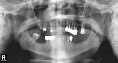 Pano pfa and kumujr - Eugenol