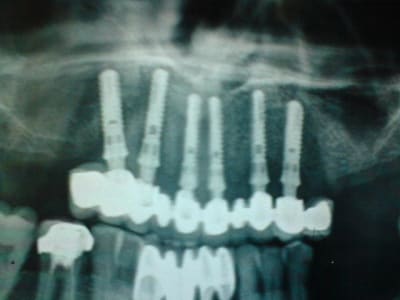 Pano2 qeqonr - Eugenol