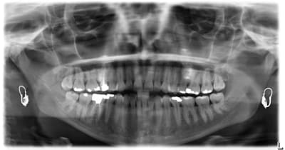 Pano fctk81 - Eugenol