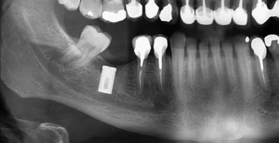 Pano imp z64nu2 - Eugenol