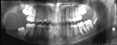 Pano lbwp8k - Eugenol